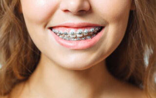 Does Getting Orthodontic Braces Hurt?